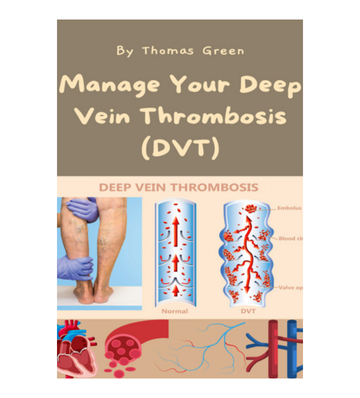 Manage Your Deep Vein Thrombosis (DVT)