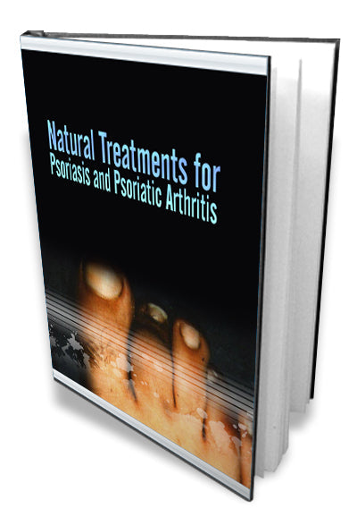 Natural Treatments For Psoriasis eBook